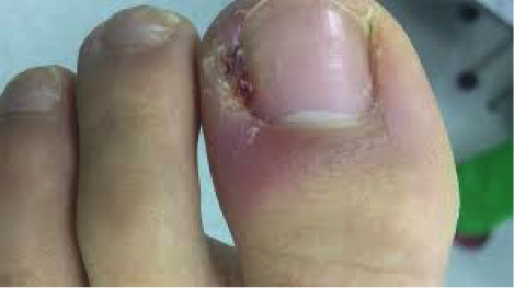 cirugia1