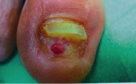 cirugia3