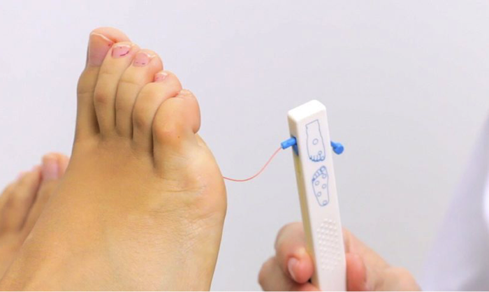 diabetico3