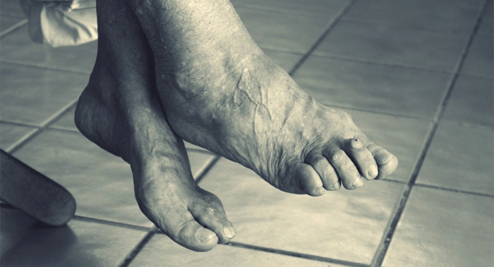 podologia_geriatrica